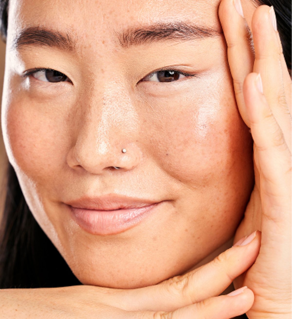 Manchas y melasma